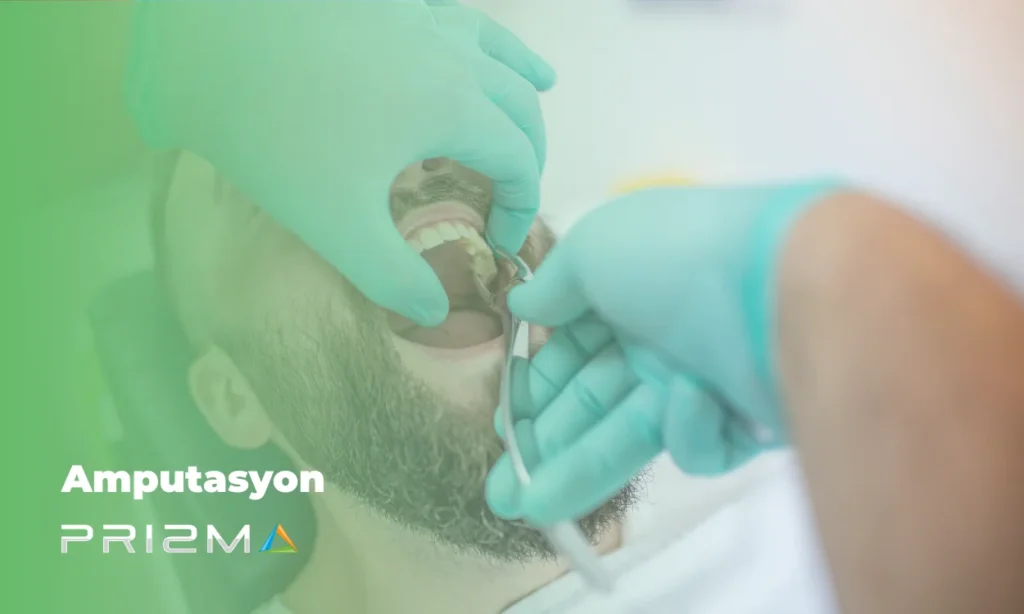 Amputasyon