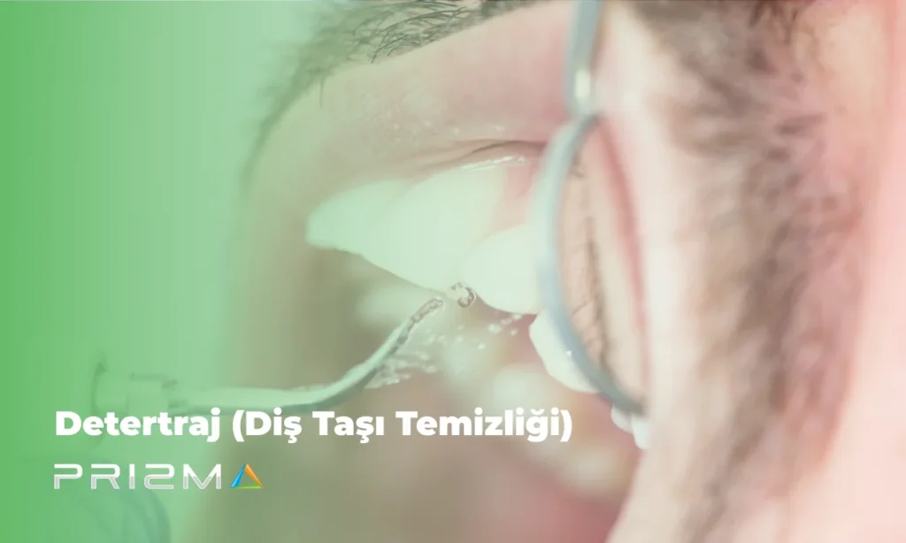 Detertraj (Diş Taşı Temizliği)
