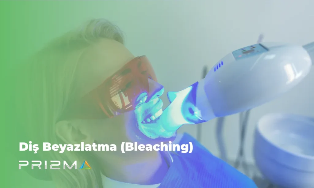 Diş Beyazlatma (Bleaching)